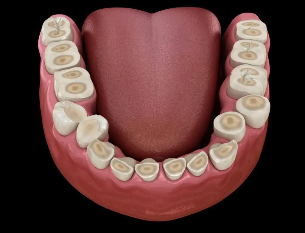 Estresse O Inimigo Invisível da Sua Saúde Bucal Introdução 