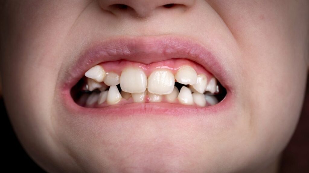 Higiene Oral Adequada