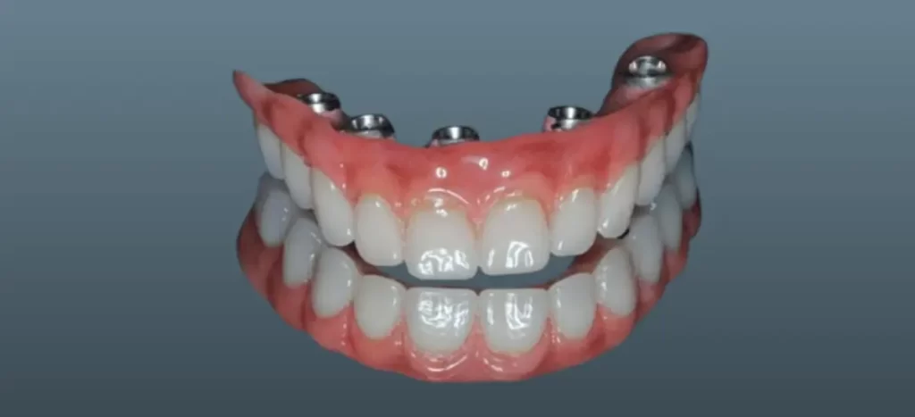 Envelhecimento e Saúde Bucal: O Que Mu